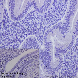Immunohistochemical analysis of paraffin-embedded human uterus tissue sections labeling Loricrin with ab198994 at a 1/500 dilution. Goat anti-rabbit IgG H&L (HRP) ab97051 used as the secondary at a 1/500 dilution. Counterstain hematoxylin. Used as a negative tissue control.