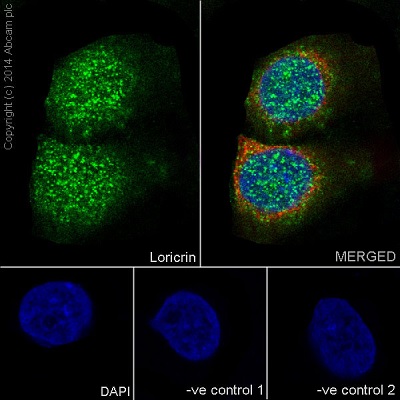 Immunocytochemistry/ Immunofluorescence analysis of A431 cell line labeling Loricrin with ab198994 at a 1/250 dilution. Cells were fixed with 4% paraformaldehyde and permeabilized using 0.1% Triton X-100. Goat anti-rabbit IgG H&L (HRP) ab97051 used as the secondary at a 1/500 dilution. Counterstained using ab7291 anti-Tubulin (mouse mAb) at a 1/1000 dilution and ab150120 AlexaFluor®594 Goat anti-Mouse secondary at a 1/500 dilution.