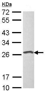 Anti-Loricrin antibody - Aminoterminal end (ab137533) at 1/1000 dilution + Raji whole cell lysate at 30 µg