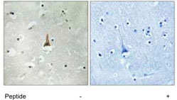 Immunohistochemistry analysis of paraffin-embedded Human brain tissue, using ab111288 at a dilution of 1/50. left panel shows staining without immunizing peptide right panel shows staining with immunizing peptide