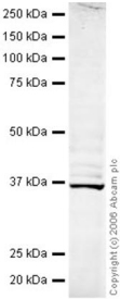 Anti-LOX antibody (ab31238) at 1 µg/ml + MDA-MB-361 whole cell lysate at 20 µgSecondaryGoat polyclonal to Rabbit IgG (Alexa Fluor® 680) at 1/10000 dilutionPerformed under reducing conditions.