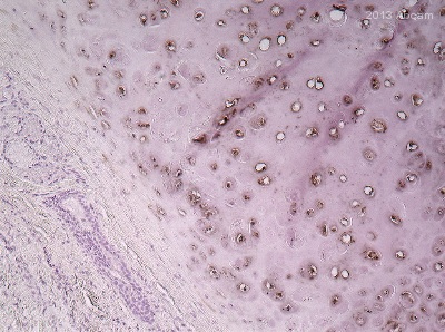 ab140833 staining LOXL2 in Human cartilage tissue sections by Immunohistochemistry (IHC-P - paraformaldehyde-fixed, paraffin-embedded sections). Tissue was fixed with formaldehyde and permeabilized with 0.2% Trioton X-100 in PBS; antigen retrieval was by heat mediation in a sodium citrate buffer (10mM sodium citrate, 0.05% Tween 20, pH 6.0). Samples were incubated with primary antibody (1/100 in PBS) for 16 hours at 4°C. An undiluted biotin-conjugated anti-rabbit IgG polyclonal was used as the secondary antibody.See Abreview