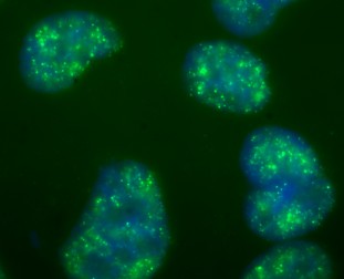 Immunofluorescent imaging of human cells (U2OS) with ab6000 reveals a diffuse background nuclear staining corresponding to global dimethylation of K4, with multiple foci of brighter staining.  The complete lack of nucleolar or cytoplasmic staining background confirms the high specificity of this antibody in this application.    IF was performed with a standard paraformaldehyde technique (fixed in PBS buffered PFH 4% for 5 minutes, permeabilised with 0.5% triton-PBS for 5 minutes, blocked with 5% milk / 0.2% tween for one hour.  Primary antibody used at 1/200 in 5% milk / 0.2% TWEEN for one hour, secondary antibody Alexa 488 for 30 minutes.  All blocking and incubation steps carried out at 37 degrees.Due to the size constraints for images on our website, unfortunately we are unable to show a higher quality image.