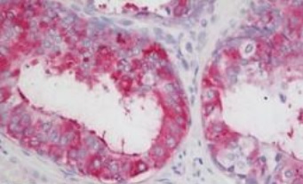 Immunohistochemistry analysis of formalin-fixed, paraffin-embedded Human prostate tissue labeling LOXL2 using ab197779 at 5 µg/ml.