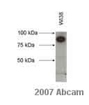 ab28320 at 1/3000 + WI38 fibroblasts whole cell lysateSecondaryHRP conjugated donkey anti-mouse polyclonal diluted 1/10000developed using the ECL techniquePerformed under non-reducing conditions.