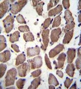 Immunohistochemical analysis of paraffin embedded Human skeletal muscle tissue labeling LRP12 with ab170501 at 1/10.