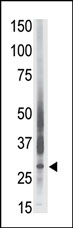 Anti-LRP15 antibody (ab38316) at 1/100 dilution + A549 cell lysate