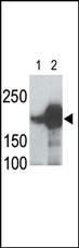 All lanes : Anti-LRP5 antibody (ab38311) at 1/1000 dilutionLane 1 : recombinant human LRP5 transfected 293 cell lysatesLane 2 : mouse LRP5 transfected 293 cell lysatesLysates/proteins at 35 µg per lane.SecondaryPeroxidase-conjugated goat anti-rabbit IgG (H+L) at 1/5000 dilution
