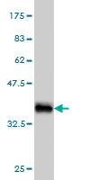 Western blot against tagged recombinant protein immunogen using ab55450 LRP5 antibody at 1ug/ml.