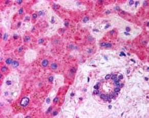 Ab24386 (5ug/ml) staining human LRP6 in human liver tissue by immunohistochemistry using paraffin embedded tissue. Steamed antigen retrieval with citrate buffer pH 6, AP-staining. In paraffin embedded Human Liver shows strong cytoplasmic staining in hepatocytes and cytoplasmic staining in bile ductulus cells.