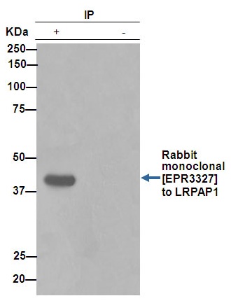 ab76500 (purified) at 1/150 immunoprecipitating LRPAP1 in human fetal kidney tissue lysate (Lane 1). Lane 2 - PBS. For western blotting, a HRP-conjugated anti-rabbit IgG, specific to the non-reduced form of IgG was used as the secondary antibody (1/1500).Blocking buffer and concentration: 5% NFDM/TBST.Diluting buffer and concentration: 5% NFDM /TBST.