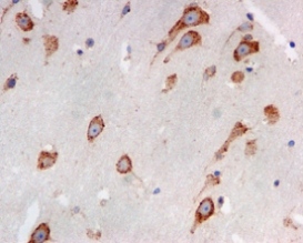 Immunohistochemical analysis of LRPAP1 in paraffin embedded Human brain tissue, using ab133488 at a 1/50 dilution.