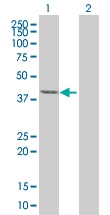 All lanes : Anti-LRRC23 antibody (ab67769) at 1/500 dilutionLane 1 : LRRC23 transfected lysateLane 2 : Non transfected lysateLysates/proteins at 25 µg per lane.SecondaryGoat Anti-Mouse IgG (H&L)-HRP conjugate at 1/2500 dilution