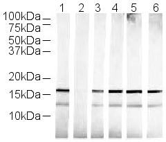 All lanes : Anti-Histone H3 (mono methyl K36) antibody - ChIP Grade (ab9048) at 1/500 dilutionLane 1 : Histone prepLane 2 : Histone prep with Human Histone H3 (mono methyl K36) peptide (ab1783) at 1 µg/mlLane 3 : Histone prep with Human Histone H3 (di methyl K36) peptide (ab1784) at 1 µg/mlLane 4 : Histone prep with Human Histone H3 (tri methyl K36) peptide (ab1785) at 1 µg/mlLane 5 : Histone prep with Human Histone H3 (unmodified ) peptide (ab2623) at 1 µg/mlLane 6 : Histone prep with Human Histone H3 (mono methyl K4) peptide (ab1340) at 1 µg/mlLysates/proteins at 0.5 µg per lane.SecondaryGoat Anti-Rabbit IgG H&L (HRP) (ab6721) at 1/5000 dilutionSecondary ab: Alexa Fluor 680 Goat anti-rabbit IgG 0.5µg histone prep used per lanePrimary antibody: Lane 1: ab9048 (Histone H3 Mono Methyl K36) 1/500Lane 2: ab9048 (Histone H3 Mono Methyl K36) 1/500 + ab1783 (ab9048) (Histone H3 Mono Methyl K36) peptide 1µg/ml Lane 3: ab9048 (Histone H3 Mono Methyl K36) 1/500 + ab1794 (ab9049) (Histone H3 Di 