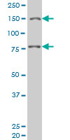 Anti-LRRFIP1 antibody (ab77598) at 1/500 dilution + HeLa nuclear extract at 25 µgSecondaryGoat anti-Mouse IgG (H&L)-HRP at 1/2500 dilution