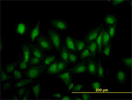 ab77598, at 10 µg/ml, staining LRRFIP1 in HeLa cells by Immunofluorescence.