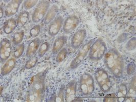 LRRFIP1 antibody (ab56486) used in immunohistochemistry at 1ug/ml on formalin fixed and paraffin embedded human small Intestine.