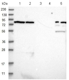 All lanes : Anti-LRRIQ3 antibody (ab122133) at 1/250 dilutionLane 1 : RT-4 cell lysateLane 2 : U-251 MG cell lysateLane 3 : Human Plasma Lane 4 : Human Liver lysateLane 5 : Human Tonsil lysatedeveloped using the ECL technique