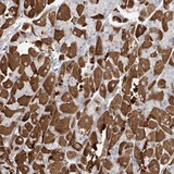 ab122133, at a 1/450 dilution, staining LRRIQ3 in paraffin embedded Human stomach tissue by Immunohistochemistry.