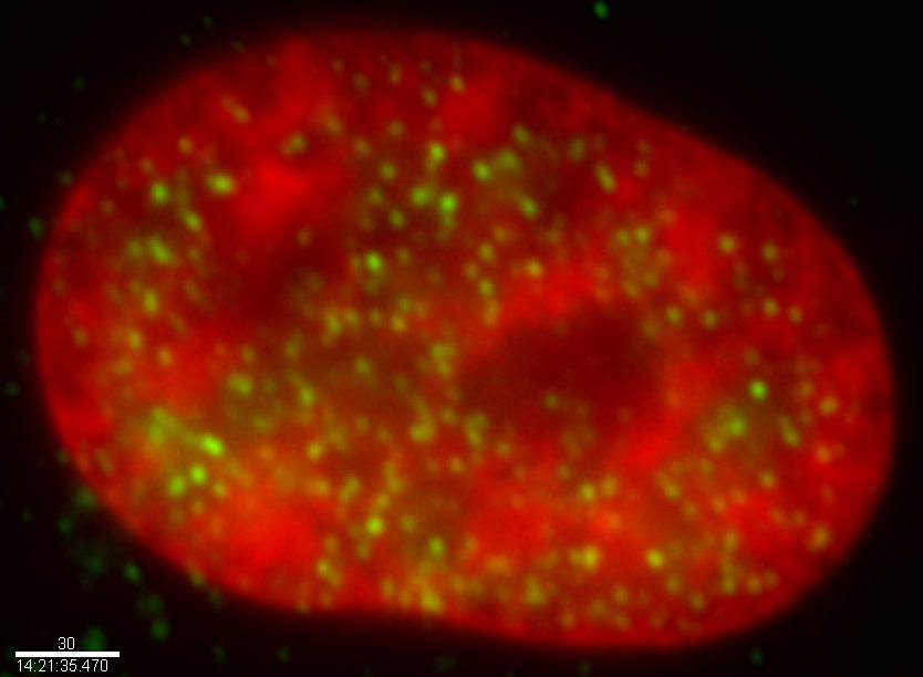 Rabbit polyclonal to Histone H3 (mono methyl K37) (1/500).Human neuroblastoma cell line SK-N-SH cultured on coverslips were fixed in 4% paraformaldehye and then stained with ab2371 (green). The DNA stained with DAPI is shown in red. (100x magnification).