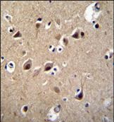 Immunohistochemical analysis of formalin-fixed, paraffin-embedded Human brain tissue labeling LRTM2 with ab170271 at 1/50 dilution followed by peroxidase-conjugated secondary antibody and DAB staining.