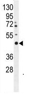 Anti-LRTM2 antibody - C-terminal (ab170271) at 1/100 dilution + HepG2 cell line lysate at 35 µg
