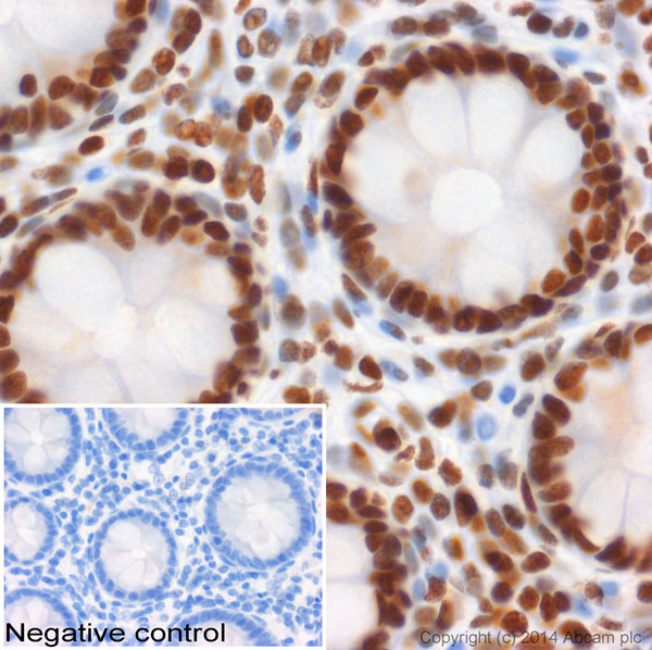 IHC image of ab8895 staining Histone H3 (mono methyl K4) in human colon formalin fixed paraffin embedded tissue sections, performed on a Leica Bond. The section was pre-treated using heat mediated antigen retrieval with sodium citrate buffer (pH6, epitope retrieval solution 1) for 20 mins. The section was then incubated with ab8895, 0.5µg/ml, for 15 mins at room temperature and detected using an HRP conjugated compact polymer system. DAB was used as the chromogen. The section was then counterstained with haematoxylin and mounted with DPX. No primary antibody was used in the negative control (shown on the inset). For other IHC staining systems (automated and non-automated) customers should optimize variable parameters such as antigen retrieval conditions, primary antibody concentration and antibody incubation times.
