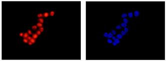 Immunofluorescence analysis of 4% paraformaldehyde fixed T47-D cells labeling LSM5 with ab184568 at a 1/500 dilution. Goat anti rabbit IgG (Alexa Fluor®555) secondary used at a 1/200 diution. Conterstained with Dapi (right image).