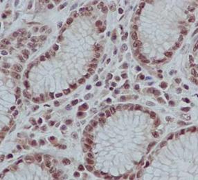 Immunohistochemical analysis of paraffin embedded Human stomach tissue labeling LSM5 with ab184568 a 1/100 dilution. Counterstained with Hematoxylin.