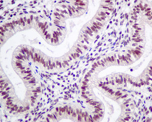 Immunohistochemical analysis of paraffin-embedded Human uterus tissue labeling LSM5 with ab151717 at 1/50 dilution.