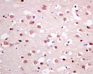 Immunohistochemical analysis of paraffin embedded normal Human brain tissue using ab151717 showing +ve staining.