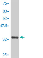 Western blot against tagged recombinant protein immunogen using ab56828 LSM6 antibody at 1ug/ml.