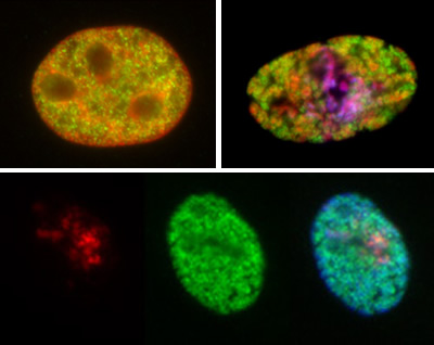 Indian muntjac fibroblast cells -  interphase (top left) and prophase (top right and below), stained with:Mono Methyl K4 antibody, ab8895, (green) DAPI: red, top left and right; blue, belowPhospho Ser 10 antibody: red (below) and blue (top right)The perinuclear and perinucleolar heterochromatin domains do not contain Mono Methyl K4.  The Mono Methyl K4, rather, is distributed as small nuclear foci primarily found between DAPI-intense regions of the nucleus.   