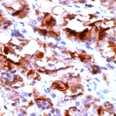 Human anterior pituitary tissue sections stained with ab15226 by Immunohistochemistry (Formalin/ PFA fixed paraffin-embedded tissue sections).