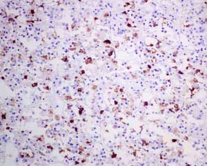 Immunohistochemical analysis of paraffin embedded Human pituitary tissue labeling Luteinizing Hormone beta with ab150378 at a 1/100 dilution.