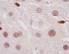 ab41902 staining LXR alpha in Rat Hepatocyte and Kupffer cell paraffin section (20-40ug/mL) by Immunohistochemistry, formalin-fixed paraffin embedded sections. 