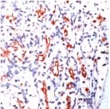 ab74344, at 1/100 dilution, staining Renal Cell Carcinoma (gp200) in formalin-fixed, paraffin-embedded normal human kidney tissue sections by Immunohistochemistry.