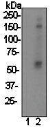 All lanes : Anti-Lyn (phospho Y396) antibody [EP503Y] (ab40660) at 1/10000 dilutionLane 1 : HeLa cell lysate, non-treated cells.Lane 2 : HeLa cell lysate, cells treated with Pervanadate.