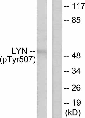 All lanes : Anti-Lyn (phospho Y507) antibody (ab53122) at 1/300 dilutionLane 1 : K562 cell extract treated with Hydrogen Peroxide (100uM, 30mins)Lane 2 : K562 cell extract treated with Hydrogen Peroxide (100uM, 30mins) with immunising peptide