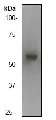 Anti-Lyn antibody [Y497] (ab32398) at 1/2000 dilution + Hela cell lysate