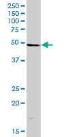 Anti-LYRIC antibody (ab168190) at 1/500 dilution + Human placenta tissue lysate at 50 µgdeveloped using the ECL technique