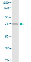 Anti-LYRIC antibody (ab168190) at 1/500 dilution + Jurkat cell lysate at 50 µgdeveloped using the ECL technique