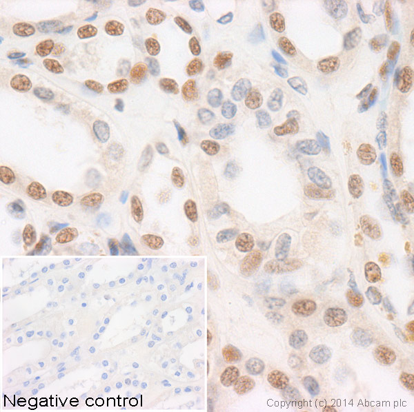 IHC image of ab47503 staining Histone H3 (mono methyl R17) in human kidney formalin fixed paraffin embedded tissue sections, performed on a Leica Bond. The section was pre-treated using heat mediated antigen retrieval with sodium citrate buffer (pH6, epitope retrieval solution 1) for 20 mins. The section was then incubated with ab130283, 5µg/ml, for 15 mins at room temperature and detected using an HRP conjugated compact polymer system. DAB was used as the chromogen. The section was then counterstained with haematoxylin and mounted with DPX. No primary antibody was used in the negative control (shown on the inset).For other IHC staining systems (automated and non-automated) customers should optimize variable parameters such as antigen retrieval conditions, primary antibody concentration and antibody incubation times.