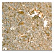 ab91606, at a 1/100 dilution, staining Lysophospholipase 1 in paraffin-embedded Human brain tissue by Immunohistochemistry.