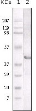 All lanes : Anti-Lysosomal acid lipase antibody [9G7F12] (ab36597)Lane 1 : Molecular weight markerLane 2 : Truncated LAL recombinant protein