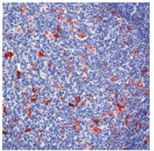 Formalin-fixed, paraffin-embedded human tonsil stained with ab74666 using peroxidase-conjugate and AEC chromogen. Note cytoplasmic staining of myeloid cells.