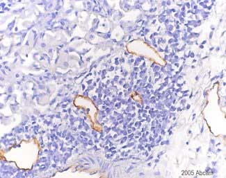 ab14917 at a 1/100 dilution staining LYVE1 from mouse tuberculosis infected lung by immunohistochemistry (paraffin-embedded sections). The antibody was incubated with the tissue for 30 minutes and then detected with an HRP conjugated goat anti-rabbit antibody. This image is courtesy of an Abreview submitted by Elizabeth Chlipala on 18 November 2005. See Abreview