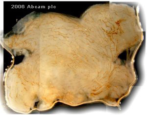 ab14917 at 1/2000 dilution staining Ha-Ras transgenic mouse bladder (cancer) by Immunohistochemistry (Formalin-fixed paraffin-embedded sections). The tissue was formaldehyde fixed and blocked with serum prior to incubation with the primary antibody for 12 hours. A biotinylated polyclonal antibody was used as the secondary.See Abreview