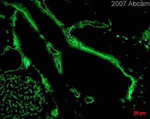  ab14917 at 1/100 staining mouse tissue sections (E17.5 lymphatic vessels by inferior vena cava) by IHC-Fr. The tissue was acetone fixed and incubated with the antibody for 2 hours in 1% BSA in PBS. An Alexa Fluor ® 488 conjugated donkey anti-rabbit IgG antibody was used as the secondary.See Abreview