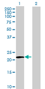 All lanes : Anti-LZIC antibody (ab69267) at 1/500 dilutionLane 1 : LZIC transfected 293T cell lysateLane 2 : Non-transfected 293T cell lysateLysates/proteins at 25 µg per lane.SecondaryGoat Anti-Mouse IgG (H&L)-HRP Conjugate at 1/2500 dilution